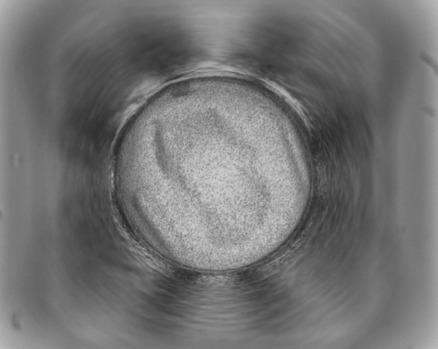 X0000095901415200802081130