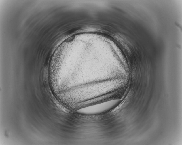 X0000095901417200802081130