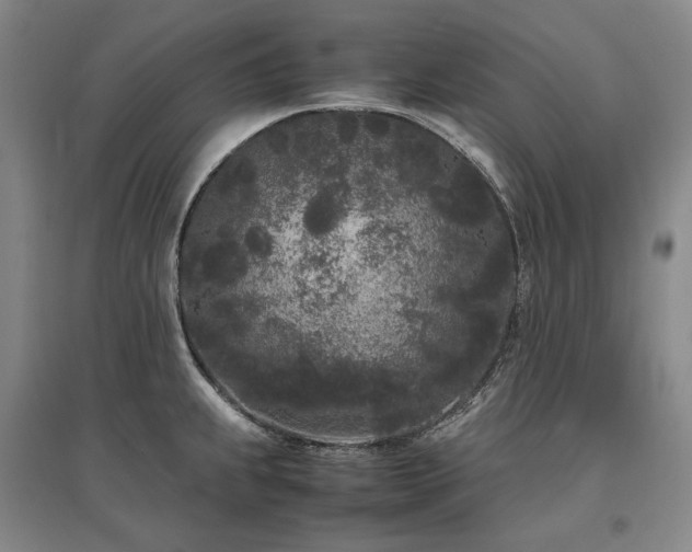 X0000095911239200801111225