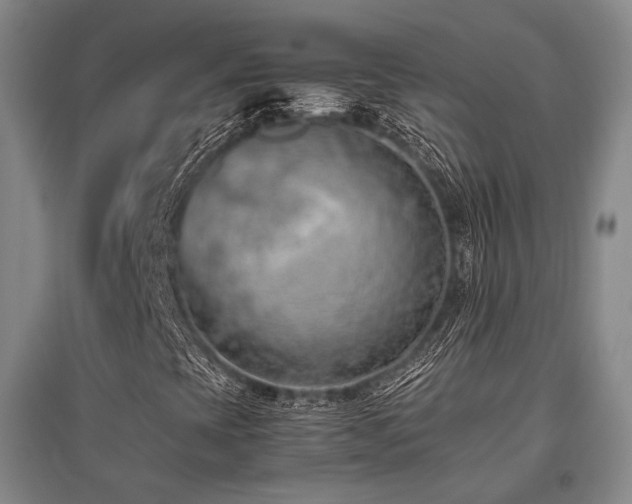 X0000095911393200801111222
