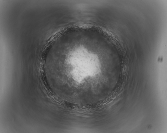 X0000095911397200801111222