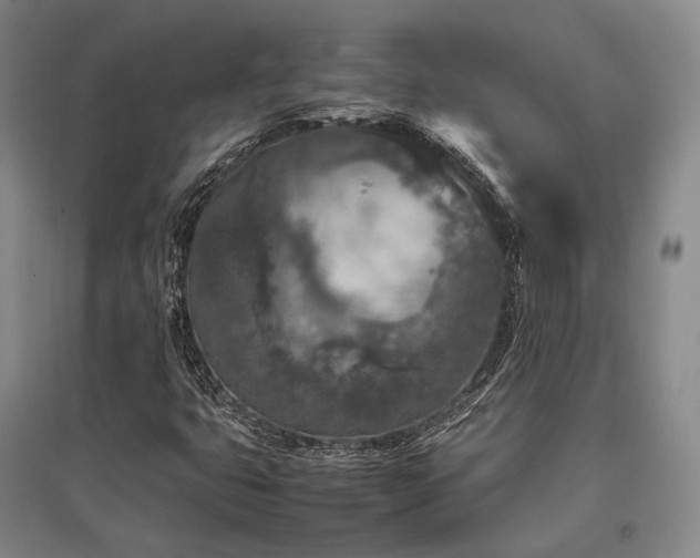 X0000095911399200801111222