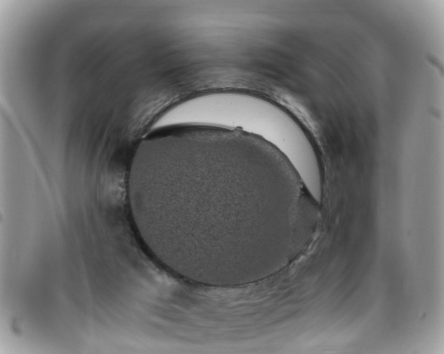 X0000095910017200801181405