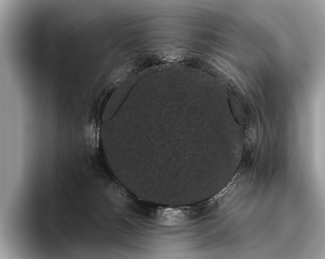 X0000095910180200801251017