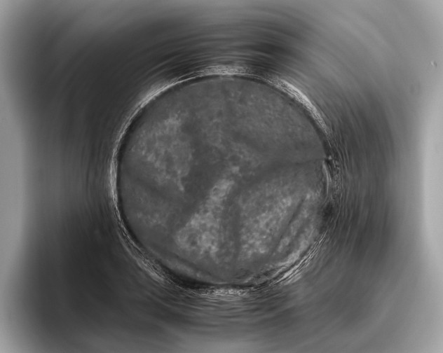 X0000095911035200801251006