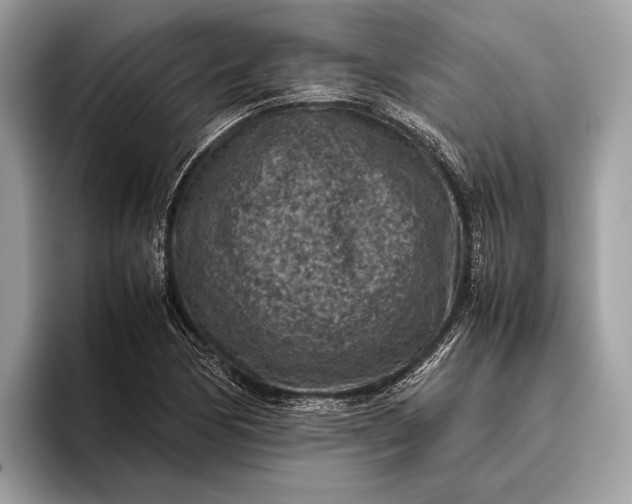 X0000095911170200801251004