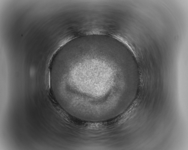 X0000095911219200801251003