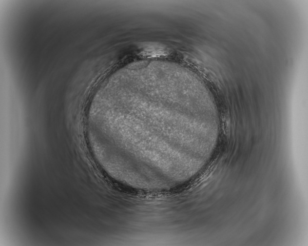 X0000095911393200801251000