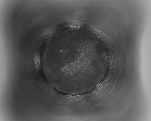 X0000095911394200801251000