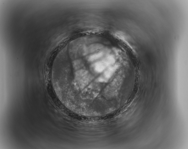 X0000095911399200801251000