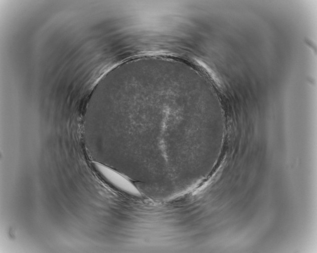 X0000095911361200802011141