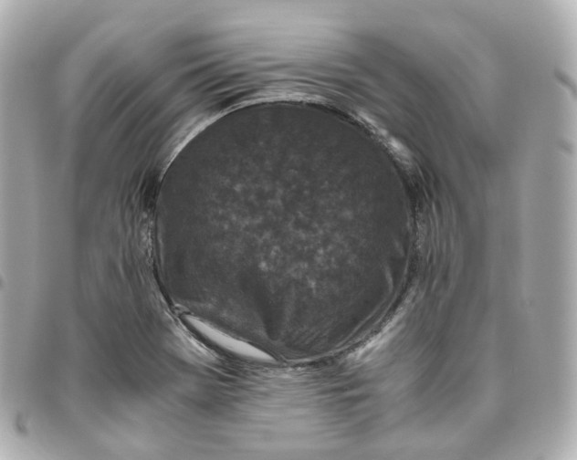 X0000095911369200802011141