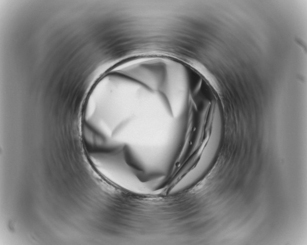 X0000095911388200802011141