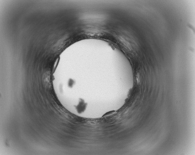 X0000095911396200802011140