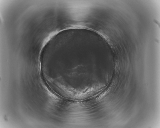 X0000095911414200802011140