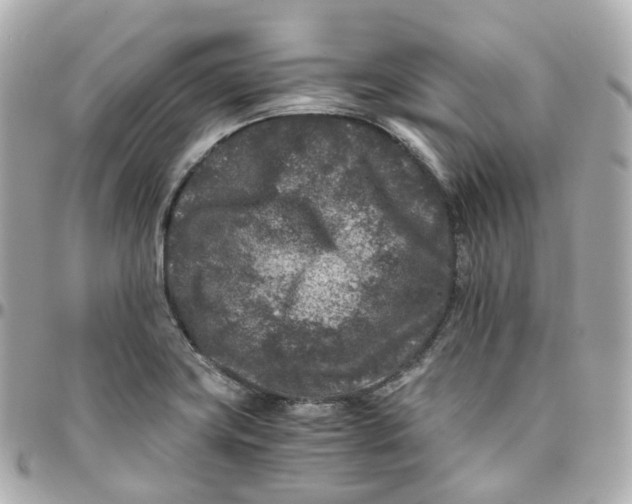 X0000095911419200802011140