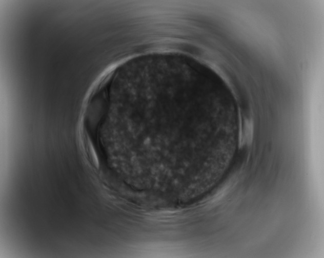 X0000095910387200802081057