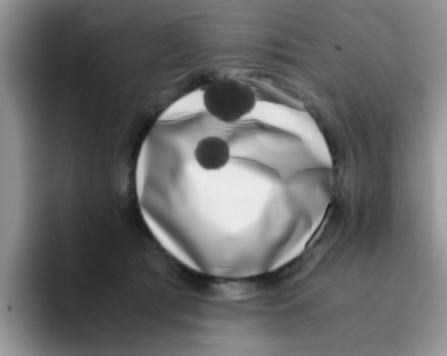 X0000095910417200802081057