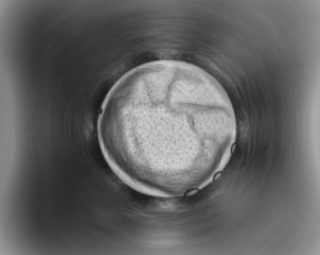 X0000095910618200802081054