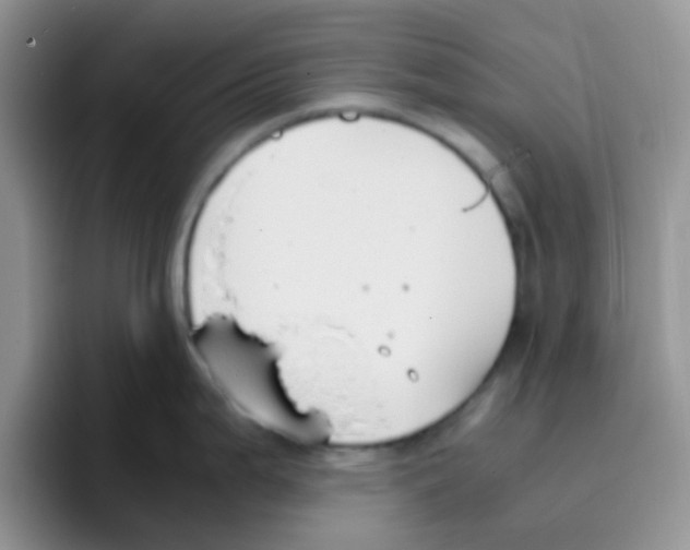 X0000095911199200802081046