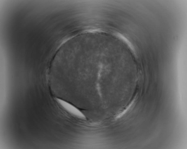 X0000095911361200802081044