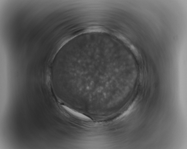 X0000095911369200802081044