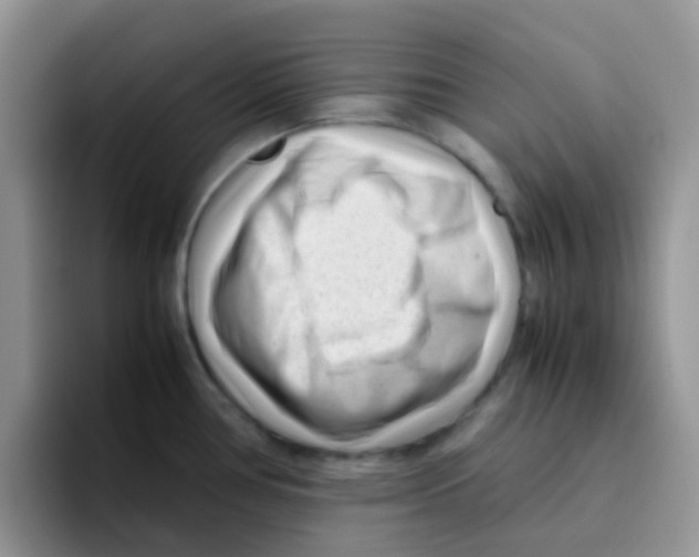 X0000095911386200802081044