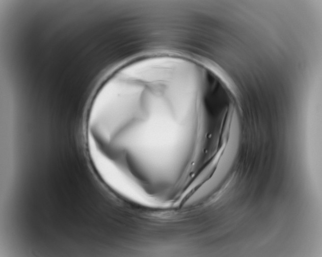 X0000095911388200802081044