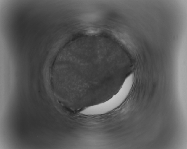 X0000095911441200802081043