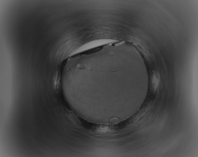 X0000095920177200801111242