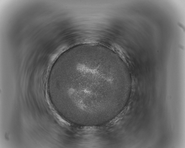 X0000095920145200801181425