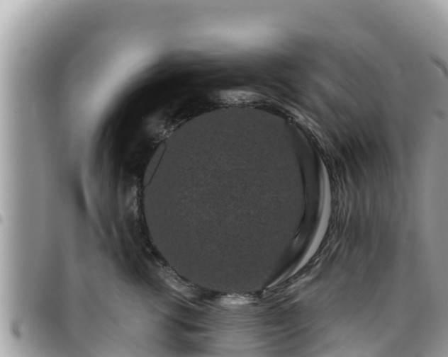 X0000095920762200801181417