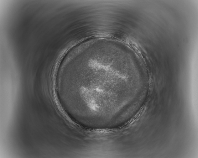 X0000095920145200801251036