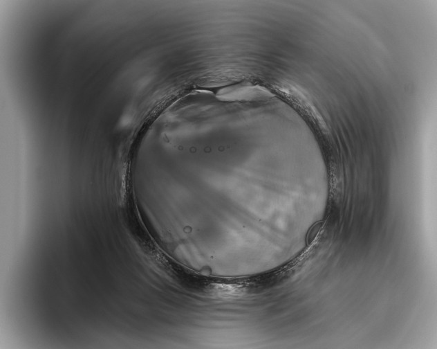 X0000095920167200801251037