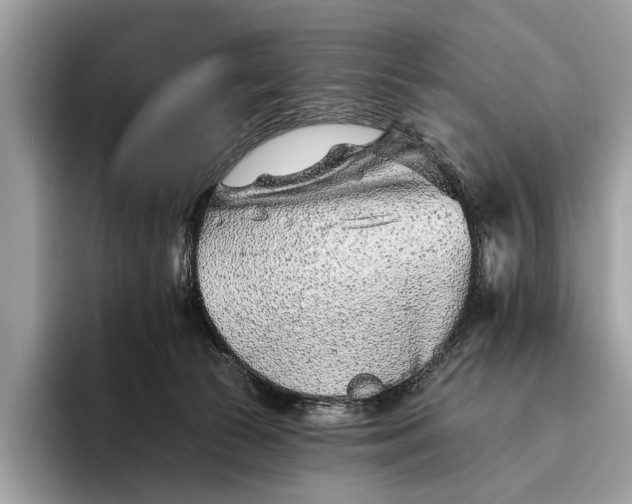 X0000095920177200801251037