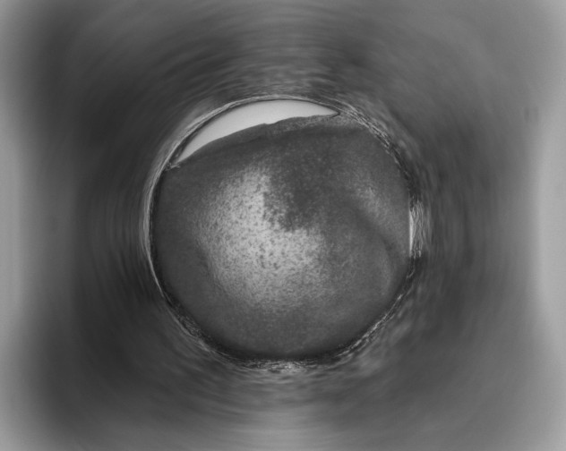 X0000095920195200801251036