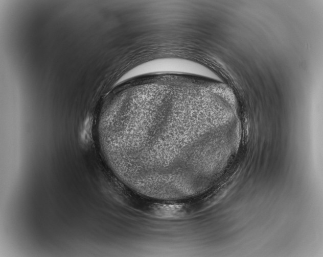 X0000095920217200801251036