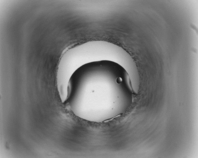 X0000095920144200802011221