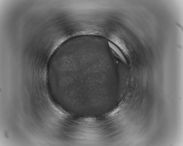 X0000095920156200802011220