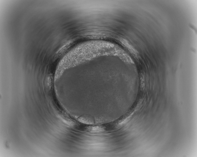 X0000095920165200802011220