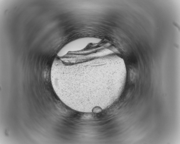 X0000095920177200802011221