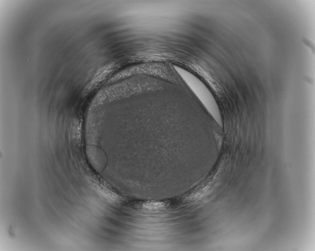 X0000095920357200802011218