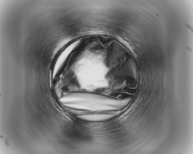 X0000095921171200802011206