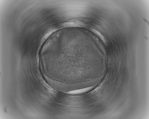 X0000095921419200802011203