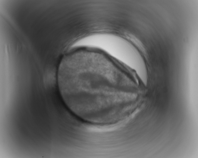 X0000095920017200802081122