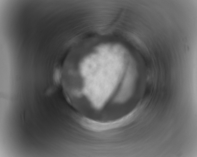 X0000095920047200802081122