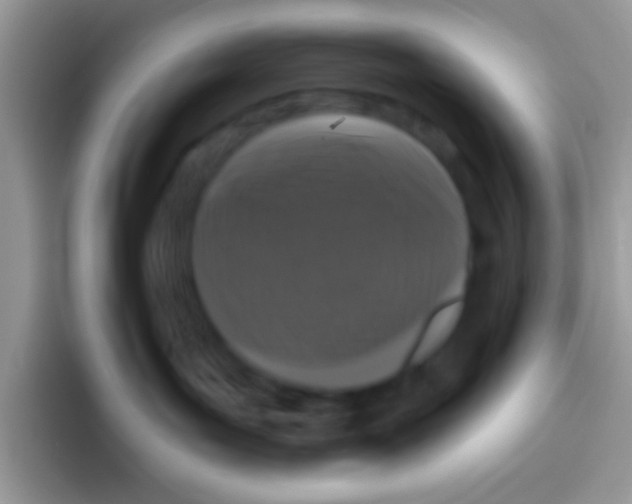 X0000095920143200802081121