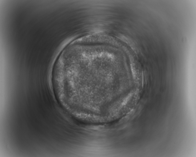 X0000095920147200802081120