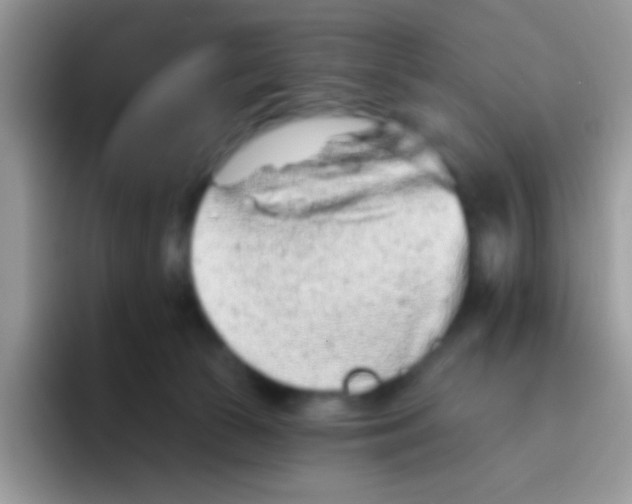 X0000095920177200802081120