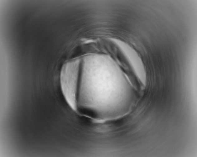 X0000095920332200802081118